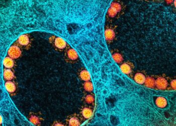 Número de casos de covid-19 passa de 22,2 milhões no país