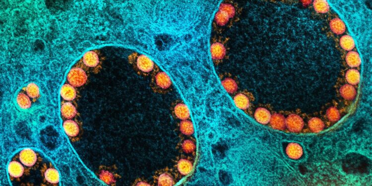 Covid-19: Brasil registra 3,8 mil novos casos e 32 óbitos em 24 horas