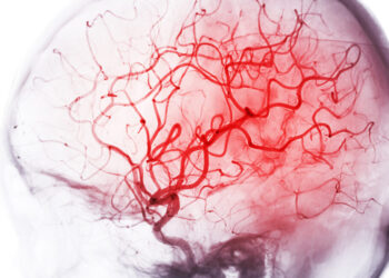 Maranhão intensifica luta contra o AVC com programa ‘Cuidar de Todos’